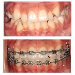 Procedures at Premier Dental Care Solutions.